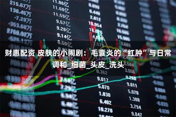 财惠配资 皮肤的小闹剧：毛囊炎的“红肿”与日常调和_细菌_头皮_洗头